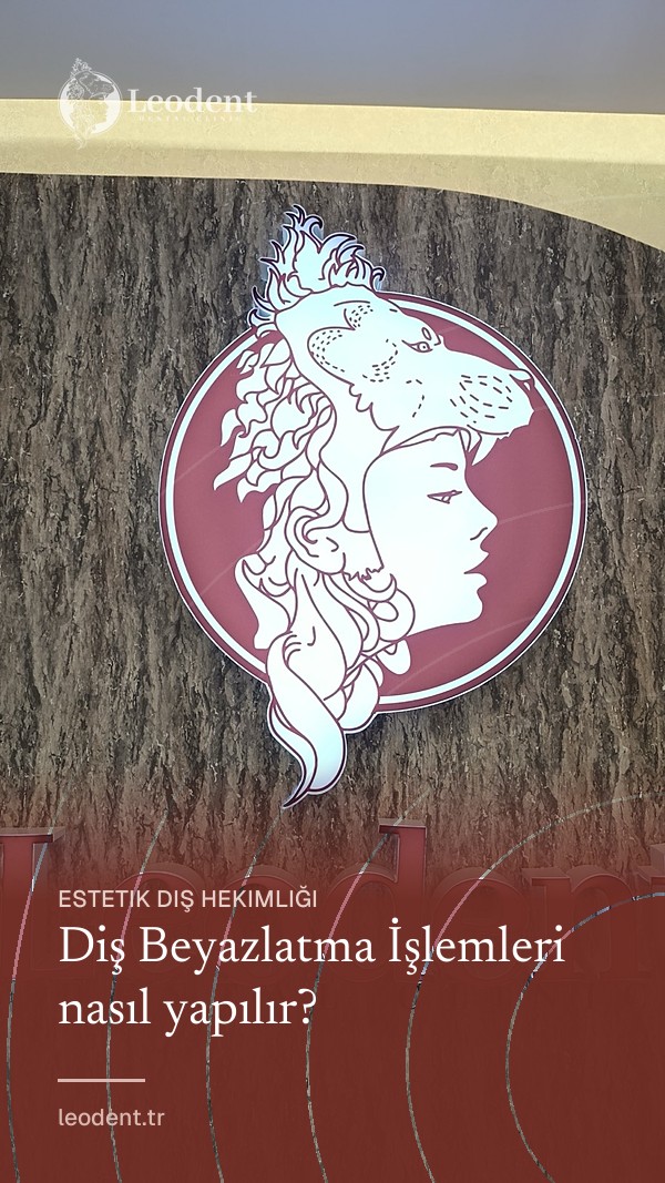 Diş Beyazlatma İşlemleri nasıl yapılır?