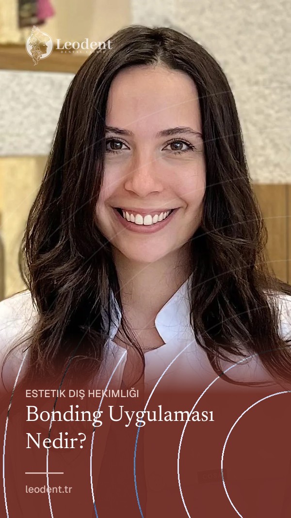 Bonding Uygulaması Nedir? | Dt. Aden Öngel
