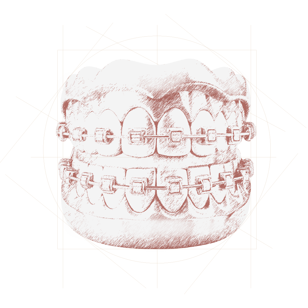 Leodent_Dental_Clinic_Bölümler_2025_Ortodonti-min